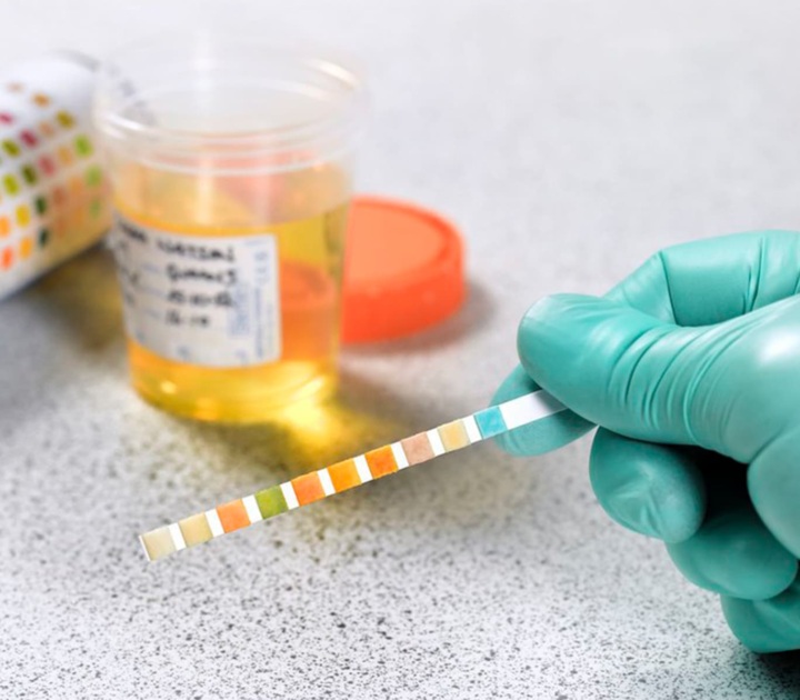 A hand holds a drug test strip; a urine specimen is in the background.